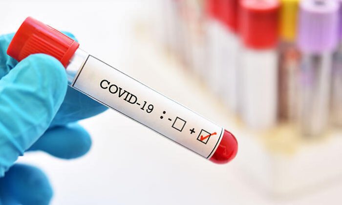 Karadağ`da 54 Aktif Covid-19 Vakası