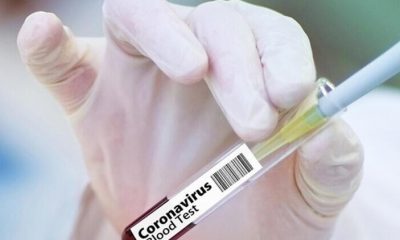 Çin Duyurdu! Koronavirüs Aşısı İçin Tarih Belli Oldu