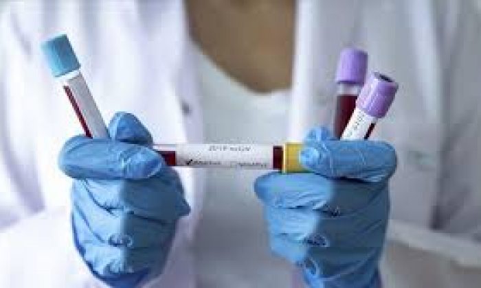 Makedonya`da Vaka Sayısı Artıyor! İşte Yeni Vakalar