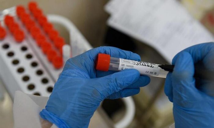 Makedonya`da 152 Yeni Vaka