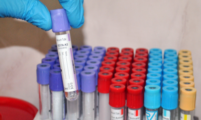 Virüse Yakalanan Bulgar Vatandaşı Hastaneden Kaçtı