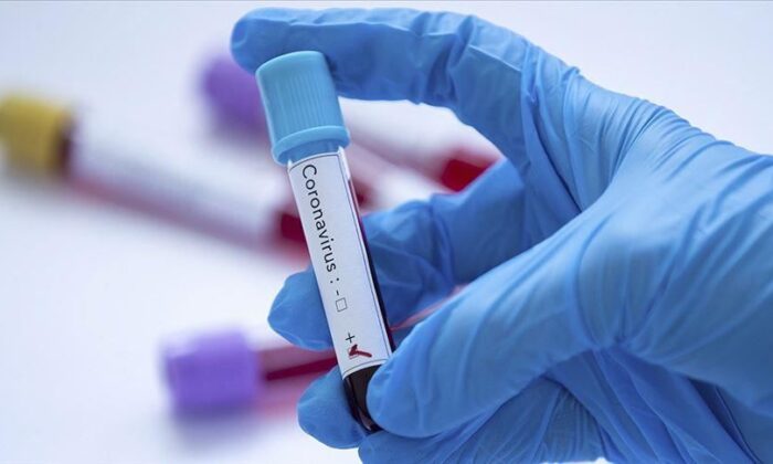 Karadağ`da 345 Yeni Vaka..12 Vefat